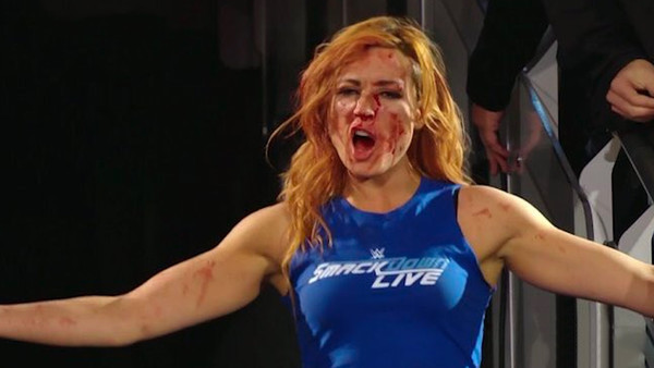 SD Superstar - Becky Lynch